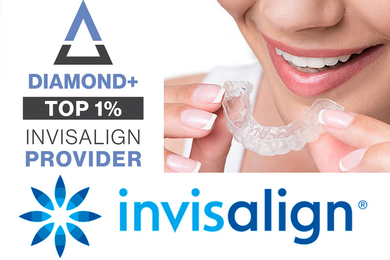 Invisalign in Folsom