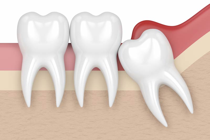 Orthodontics in Folsom